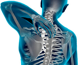 Manifestations of osteochondosis of the thoracic spine