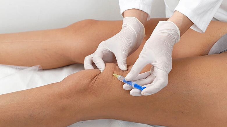 Intra -articular injection for knee arthrosis